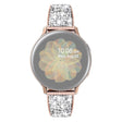 Absolutamente Estilosa Universal Metal Universal Correa Reloj